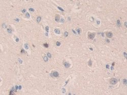 Invitrogen SMC3 Polyclonal Antibody:Antibodies:Primary Antibodies