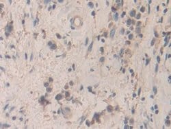 Invitrogen SMC3 Polyclonal Antibody:Antibodies:Primary Antibodies