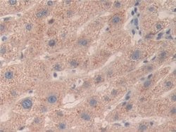 Invitrogen SMC3 Polyclonal Antibody:Antibodies:Primary Antibodies