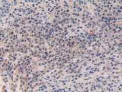 Invitrogen SMC3 Polyclonal Antibody:Antibodies:Primary Antibodies