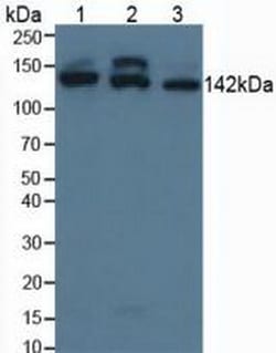 Invitrogen SMC3 Polyclonal Antibody 200 &mu;L; Unconjugated:Antibodies,