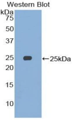 Invitrogen SMC3 Polyclonal Antibody:Antibodies:Primary Antibodies