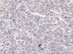 Invitrogen SULF2 Polyclonal Antibody:Antibodies:Primary Antibodies