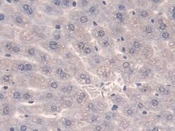 Invitrogen SULF2 Polyclonal Antibody:Antibodies:Primary Antibodies