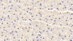 Invitrogen SOD1 Polyclonal Antibody 200 &mu;L | Buy Online | Invitrogen&trade; | Fisher Scientific