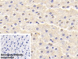 Invitrogen SOD1 Polyclonal Antibody 200 &mu;L | Buy Online | Invitrogen&trade; | Fisher Scientific