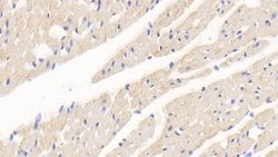 Invitrogen SOD2 Polyclonal Antibody 200 &mu;L; Unconjugated:Antibodies,