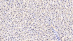 Invitrogen SOD2 Polyclonal Antibody 200 &mu;L; Unconjugated:Antibodies,