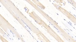 Invitrogen SOD2 Polyclonal Antibody 200 &mu;L; Unconjugated:Antibodies,