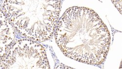 Invitrogen SOD2 Polyclonal Antibody 200 &mu;L; Unconjugated:Antibodies,