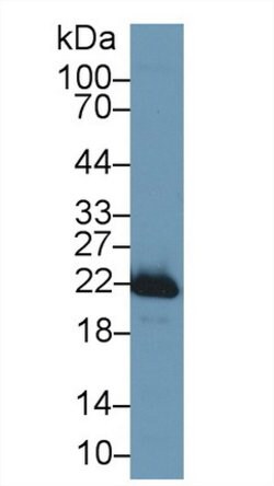 Invitrogen SOD2 Polyclonal Antibody 200 &mu;L; Unconjugated:Antibodies,