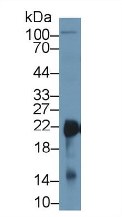 Invitrogen SOD2 Polyclonal Antibody 200 &mu;L; Unconjugated:Antibodies,