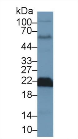 Invitrogen SOD2 Polyclonal Antibody 200 &mu;L; Unconjugated:Antibodies,