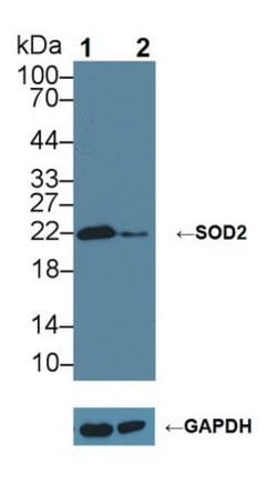 Invitrogen SOD2 Polyclonal Antibody 200 &mu;L; Unconjugated:Antibodies,