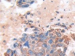 Invitrogen SOD2 Polyclonal Antibody 200 &mu;L; Unconjugated:Antibodies,