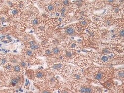 Invitrogen SOD2 Polyclonal Antibody 20 &mu;L; Unconjugated:Antibodies,