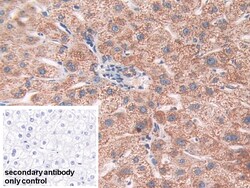 Invitrogen SOD2 Polyclonal Antibody 20 &mu;L; Unconjugated:Antibodies,