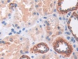 Invitrogen SOD2 Polyclonal Antibody 200 &mu;L; Unconjugated:Antibodies,