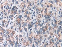 Invitrogen SOD2 Polyclonal Antibody 200 &mu;L; Unconjugated:Antibodies,