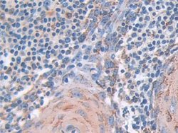 Invitrogen SOD2 Polyclonal Antibody 200 &mu;L; Unconjugated:Antibodies,