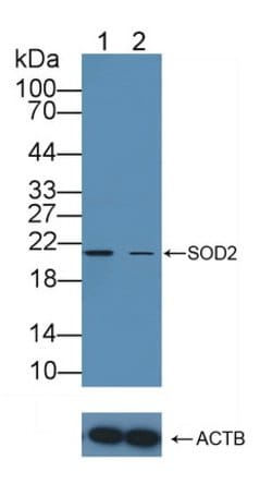 Invitrogen SOD2 Polyclonal Antibody 200 &mu;L; Unconjugated:Antibodies,