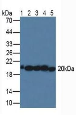 Invitrogen SOD2 Polyclonal Antibody 20 &mu;L; Unconjugated:Antibodies,