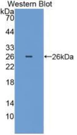 Invitrogen SOD2 Polyclonal Antibody 200 &mu;L; Unconjugated:Antibodies,