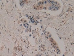 Invitrogen CCS Polyclonal Antibody:Antibodies:Primary Antibodies