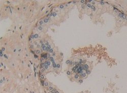 Invitrogen CCS Polyclonal Antibody:Antibodies:Primary Antibodies