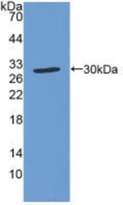 Invitrogen CCS Polyclonal Antibody:Antibodies:Primary Antibodies