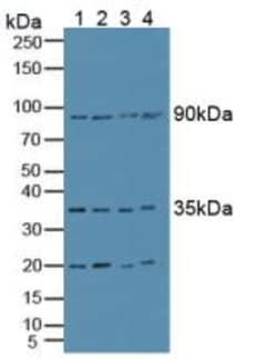 Invitrogen CCS Polyclonal Antibody:Antibodies:Primary Antibodies