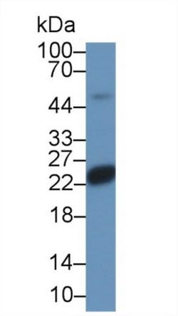 Invitrogen SOCS2 Polyclonal Antibody 200 &mu;L; Unconjugated:Antibodies,