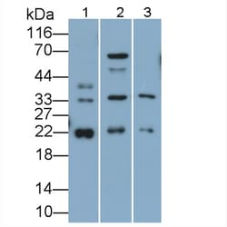 Invitrogen SOCS2 Polyclonal Antibody 200 &mu;L; Unconjugated:Antibodies,