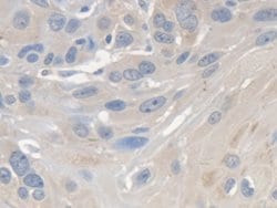 Invitrogen SMN2 Polyclonal Antibody 20 &mu;L; Unconjugated:Antibodies,