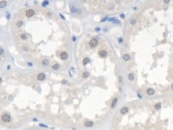 Invitrogen SMN2 Polyclonal Antibody 20 &mu;L; Unconjugated:Antibodies,