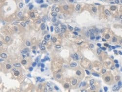 Invitrogen SMN2 Polyclonal Antibody 20 &mu;L; Unconjugated:Antibodies,