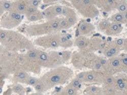 Invitrogen SMN2 Polyclonal Antibody 20 &mu;L; Unconjugated:Antibodies,