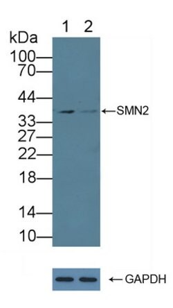 Invitrogen SMN2 Polyclonal Antibody 20 &mu;L; Unconjugated:Antibodies,