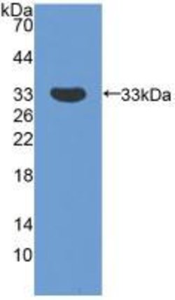 Invitrogen SMN2 Polyclonal Antibody 20 &mu;L; Unconjugated:Antibodies,