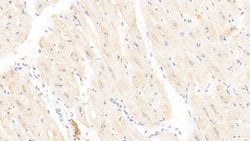 Invitrogen Syntenin 1 Polyclonal Antibody 20 &mu;L; Unconjugated:Antibodies,