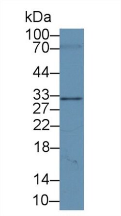 Invitrogen Syntenin 1 Polyclonal Antibody 20 &mu;L; Unconjugated:Antibodies,