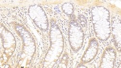 Invitrogen Syntenin 2 Polyclonal Antibody 20 &mu;L; Unconjugated:Antibodies,