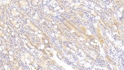 Invitrogen Syntenin 2 Polyclonal Antibody 20 &mu;L; Unconjugated:Antibodies,