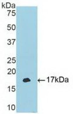 Invitrogen TBX3 Polyclonal Antibody 20 &mu;L; Unconjugated:Antibodies,