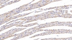 Invitrogen Tenascin C Polyclonal Antibody:Antibodies:Primary Antibodies