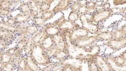 Invitrogen Tenascin C Polyclonal Antibody:Antibodies:Primary Antibodies