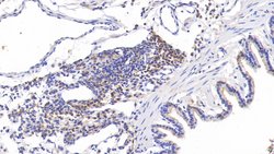 Invitrogen Tenascin C Polyclonal Antibody:Antibodies:Primary Antibodies