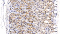 Invitrogen Tenascin C Polyclonal Antibody:Antibodies:Primary Antibodies