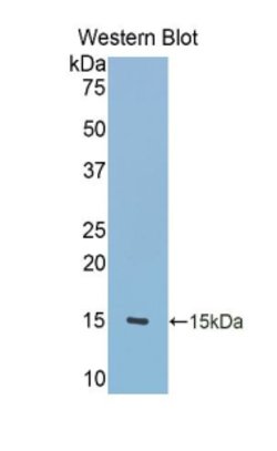 Invitrogen Tenascin C Polyclonal Antibody:Antibodies:Primary Antibodies