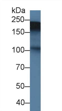 Invitrogen Tenascin C Polyclonal Antibody:Antibodies:Primary Antibodies
